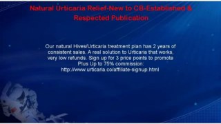 Natural Urticaria Relief-New To CB-Established & Respected Publication
