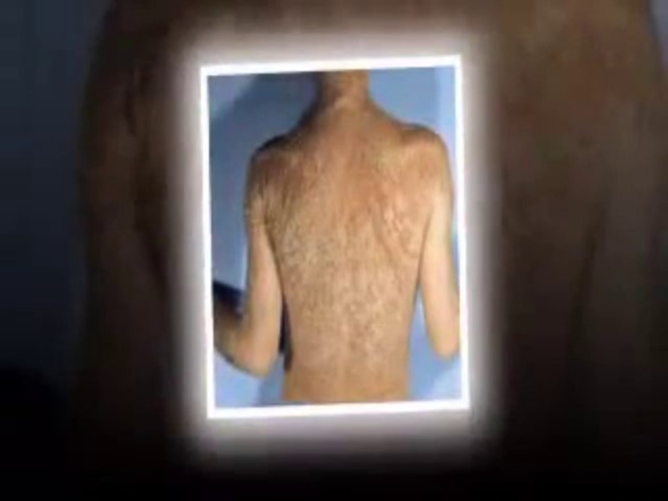 Psoriasis Free For Life: Psoriasis Free For Life todella toi