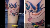 Tattoo Removal Cream - Get Rid Tattoo [Discounted Price]