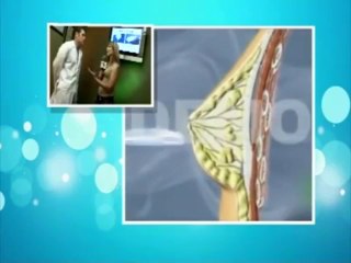 Aumento de Busto | Cesar Tamez Dr Cirugia Plastica Monterrey