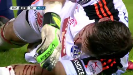 Le gardien de foot David Zibung se fait écraser la figure!! Super League Suisse - FC Lucerne