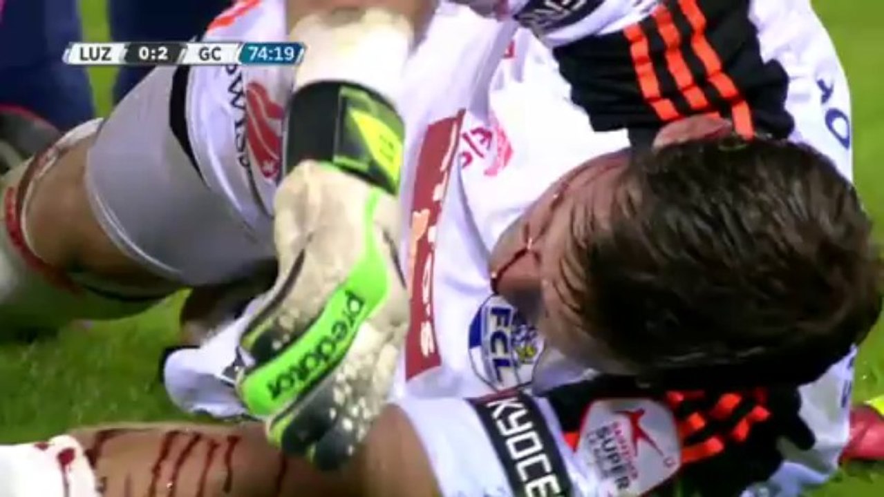 Swiss Soccer Player Izet Hajrovic Steps on Goalkeeper David Zibung’s Face!!