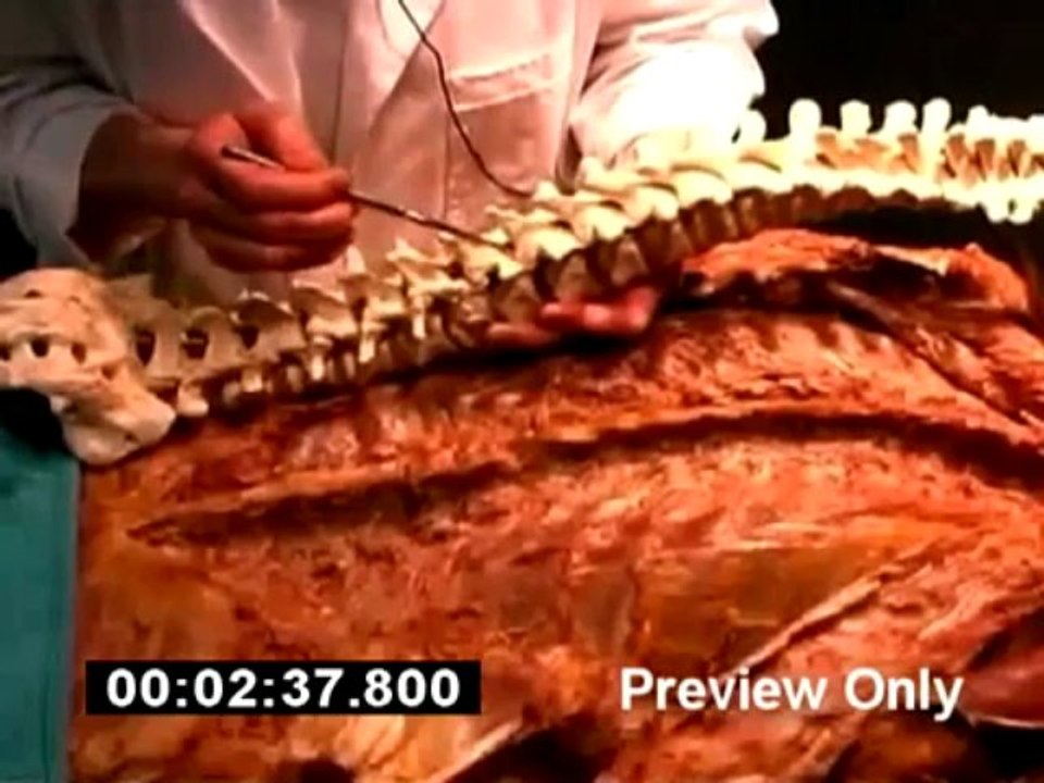 Human Anatomy: Dissections (DVD-ROM Preview)