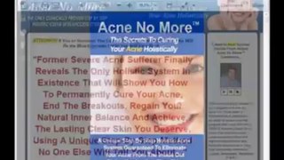 Acne No More Review - Product WalkThrough of Acne No More