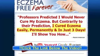 Eczema Free Forever Review - Is It Worth It?