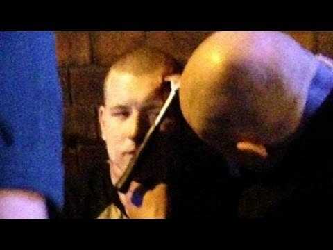 Hammer Time: Brutal Attack on rugby player leaves tool embedded deep in head