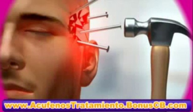 Milagro Para El Acufeno - ACUFENOS TINNITUS - Acufenos Causas - Acufenos en los Oidos