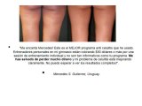 celulitis nunca mas Aprende los secretos de celulitis nunca mas eliminar celulitis