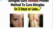 Fast Shingles Cure Review +  Fast Shingles Cure