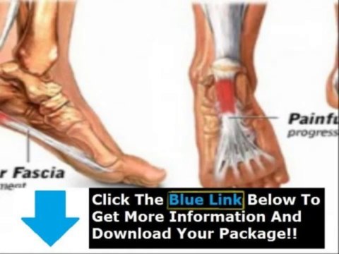 Plantar Fasciitis Treatment Night Splints + Plantar Fasciitis Treatment Ice