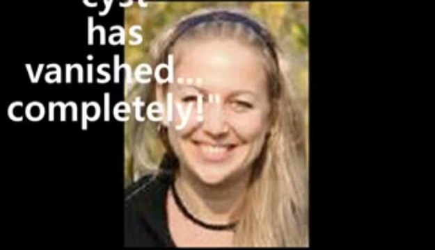 Dermoid Ovarian Cyst Ovarian Cyst Miracle- Bonuses $365.87!