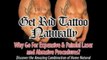 HowTo: Get Rid Tattoo - Natural Tattoo Removal Solutions