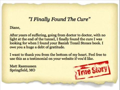 Banish Tonsil Stones | Banish Tonsil Stones Guide