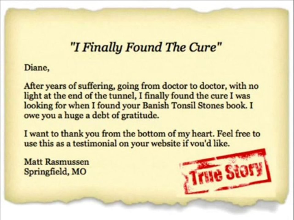 Banish Tonsil Stones | Banish Tonsil Stones Guide