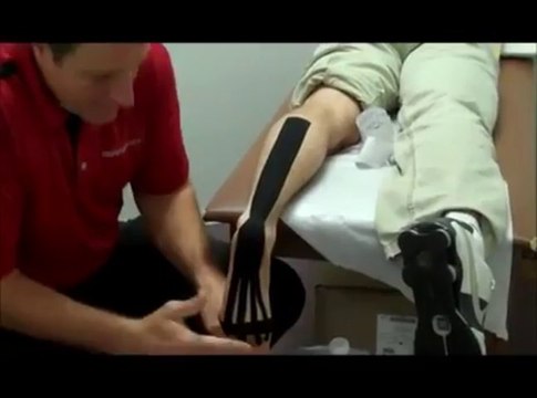 Kinesiology Tape for Heel Pain or Plantar Fasciitis