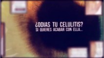 Como Quitar La Celulitis - Metodo Celulitis Nunca Mas