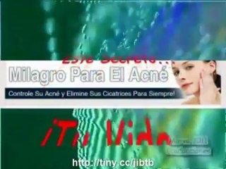 Milagro para el Acne | Como Eliminar el Acne | Como combatir el Acne