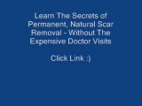 scar solution (acne scar removal) home scar treatment