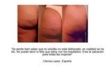 Celulitis Nunca Mas La Cura Natural Pdf / Celulitis Nunca Mas La Cura Natural Pdf Descargar Ahora