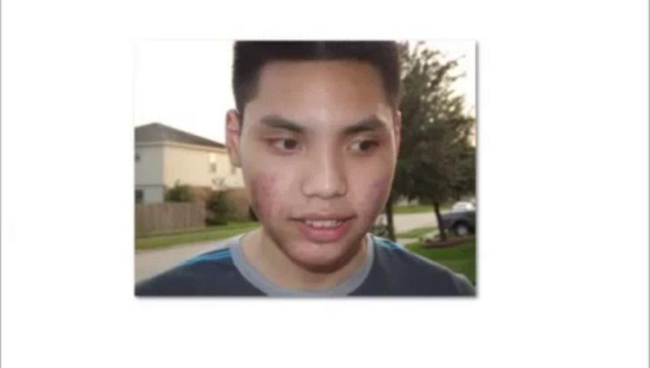 mike walden Acne No More