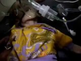 Suriye'de çocuklar açlıktan ölüyor