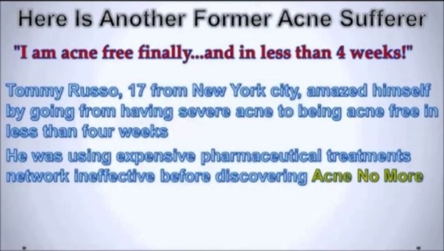 Best anti wrinkle cream reviews - Acne no more [Dr Oz product!]