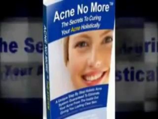 Acne No More : There is a cure or nearly all types of acne