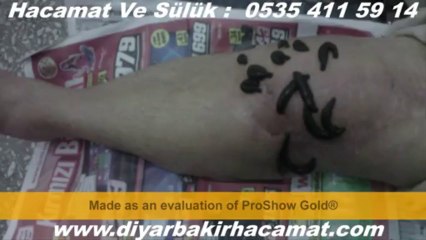 SÜLÜK HACAMAT DİYARBAKIR 0535 411 59 14