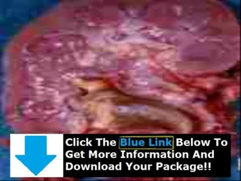 Kidney Stone Home Remedy India + Homeopathic Kidney Stone Remedy