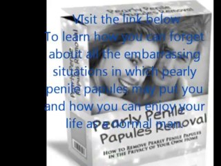 pearly penile papules removal