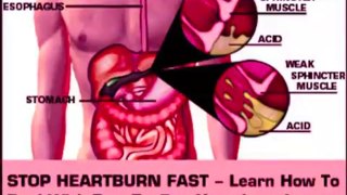 Heartburn Relief: Heartburn Relief Heartburn No More