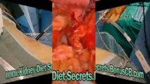 kidney diet for humans - kidney diet secrets review - renal diet books - kidney diet recipes renal