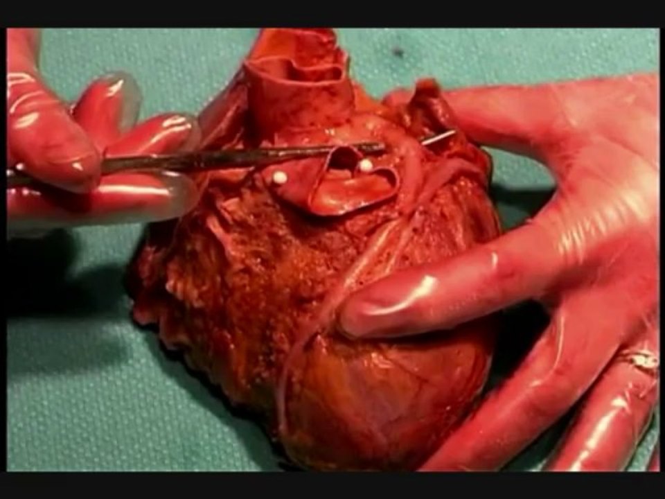 Human Anatomy Dissection 04 (part 2 of 2) Thorax