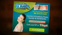 Banish My Bumps Ebook | Banish My Bumps