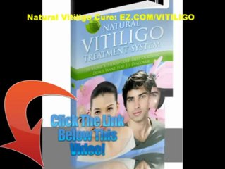 NATURAL VITILIGO TREATMENT SYSTEM TIPS