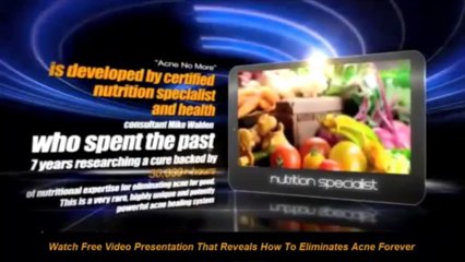 Acne No More - Cure Acne Holistically