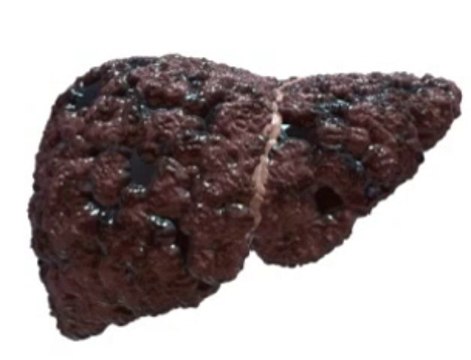 The Fatty Liver Bible & Ezra Protocol Review + Bonus