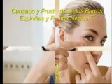 Como quitar el acne - Milagro para el acne