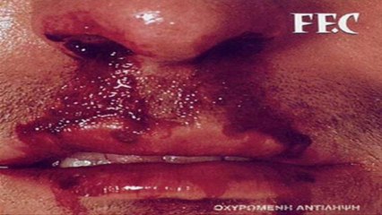 Στο Ήρεμο Στο Άγριο - FF.C (Fortified Concept)