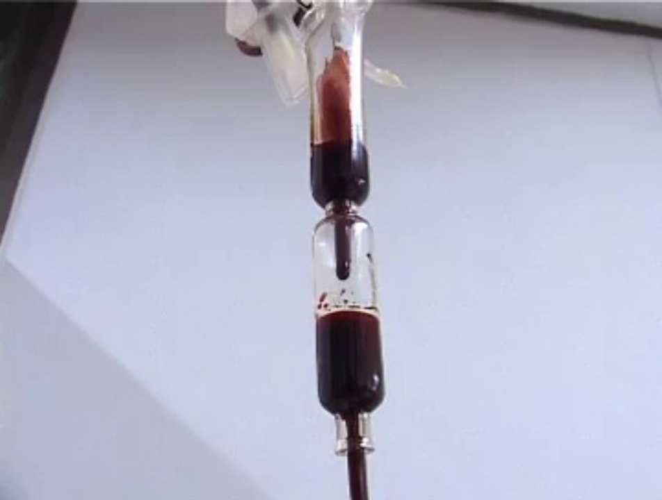REPORT ON THEALASEMIA