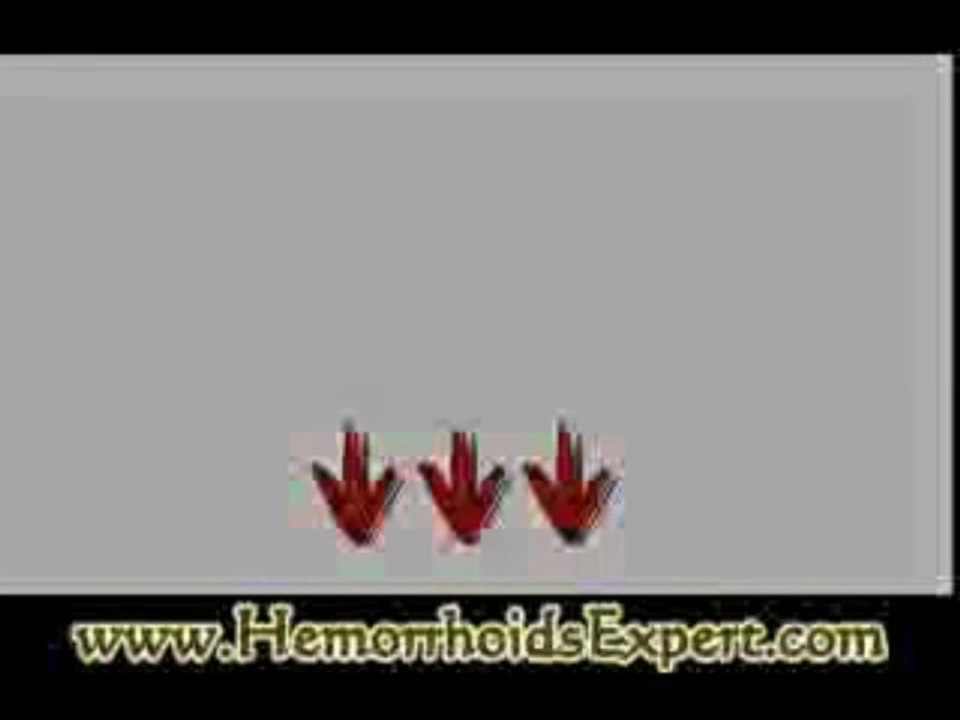 Hemorrhoid Miracle - User Review - The End of Hemorrhoids As We Know It