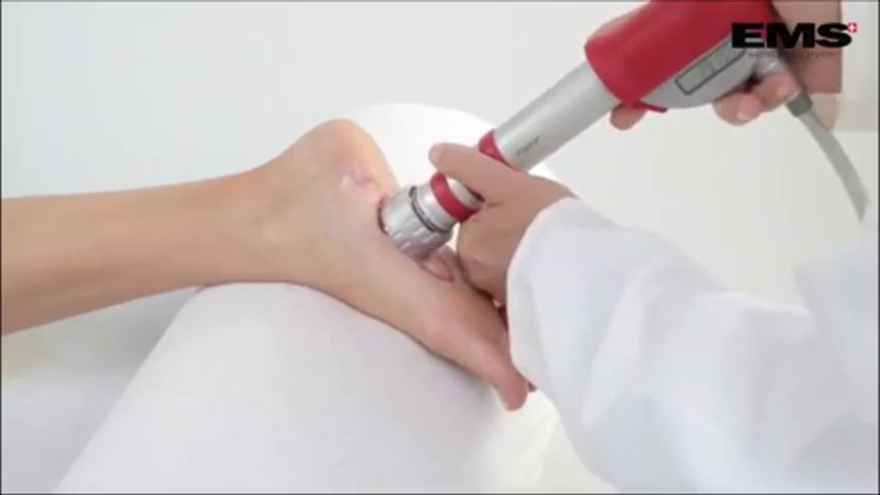 Plantar fasciitis treatment