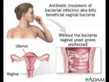 Natural Cure for Yeast Infection: The Professional Treatment