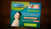 Does Banish My Bumps Really Work | Banish My Bumps Ebook