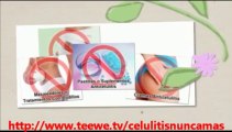 Celulitis Nunca Mas La Cura Natural - Testimonio de Monicá - Eliminar Estrias!