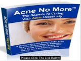 Acne No More PDF and Ebook Review - Does It Really Good?