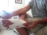 Plantar Fasciitis Taping