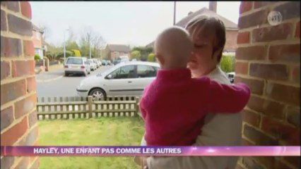 Tous différents - Hayley, une enfant pas comme les autres