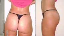 Truth about Cellulite Video reviews -#Best natural cellulite treatment