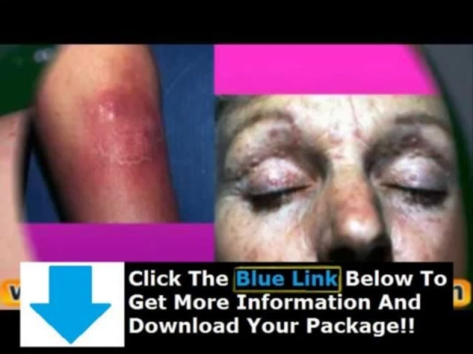 The Lupus Bible + Lupus Bible